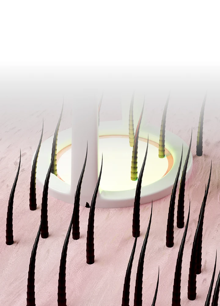tune_1_M
