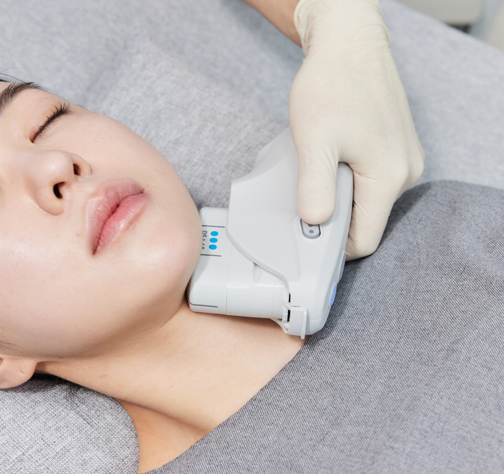 ULTHERAPY PRIME hover