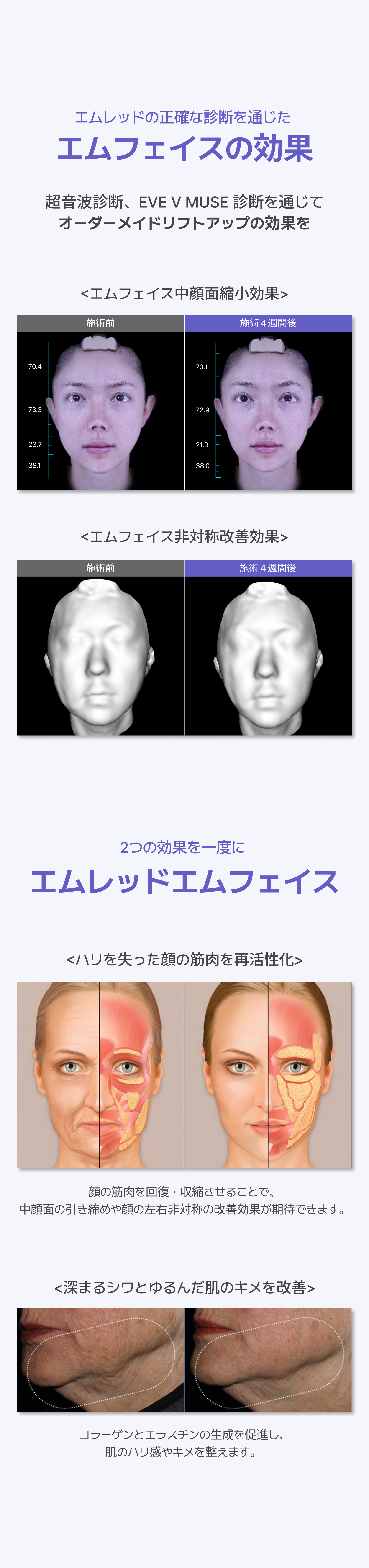 detailImage