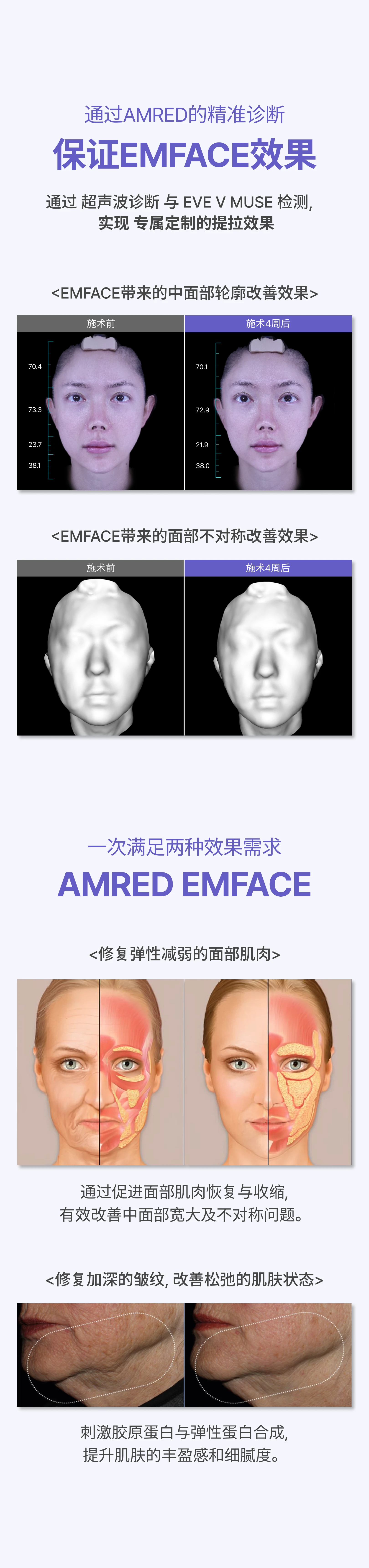 detailImage