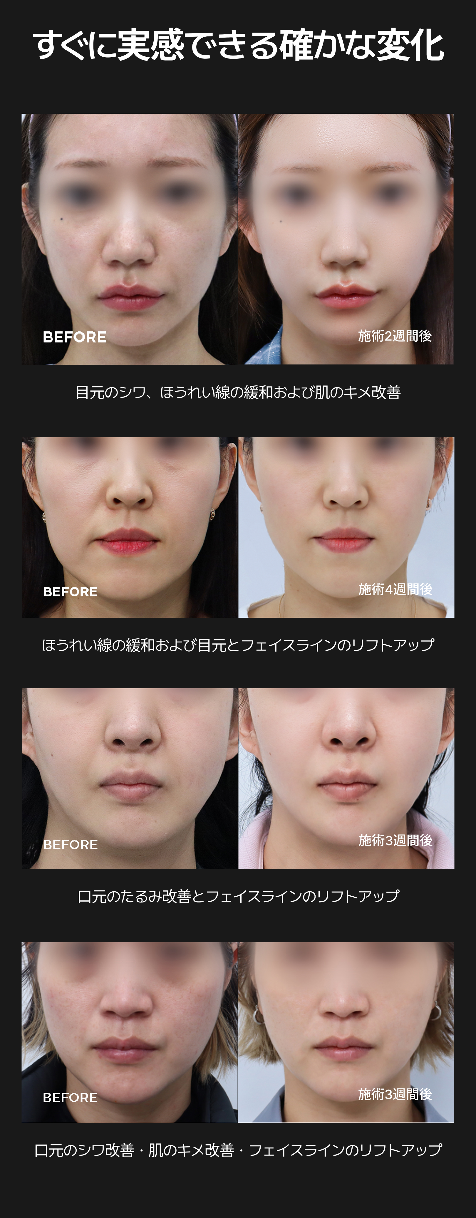 detailImage